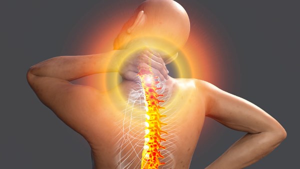 لماذا يُصاب بعض الأشخاص بالفيبروميالجيا دون غيرهم؟