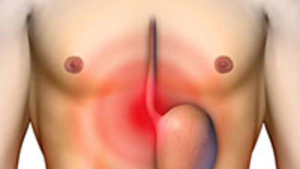  أفضل الطرق الطبيعية لعلاج مشكلات الهضم..