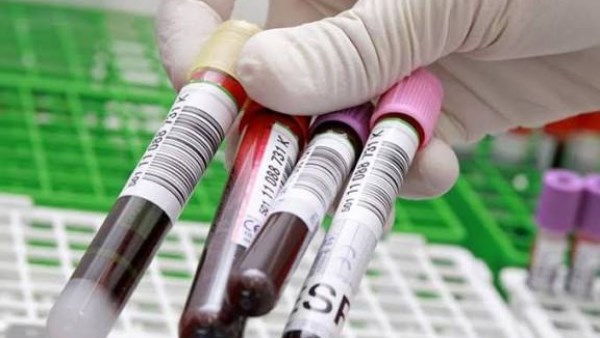 كيفية قراءة صورة الدم الكاملة (CBC)