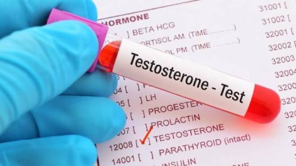 مخاطر إرتفاع هرمون التستوستيرون عند الرجال