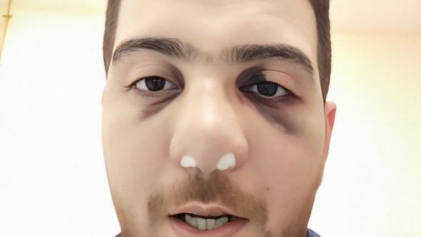 طبيب الباجور