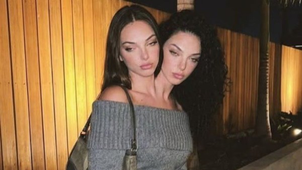 التوأم الملتصق فاليريا وكاميلا 