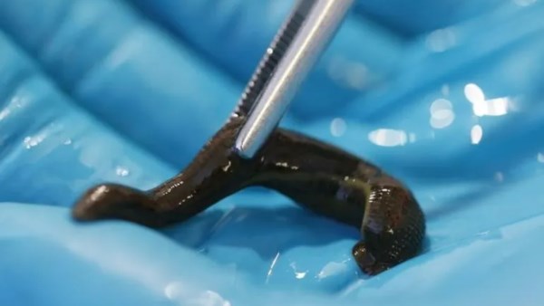 ديدان العلق