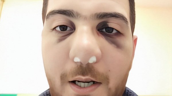 الطبيب المعتدي عليه 