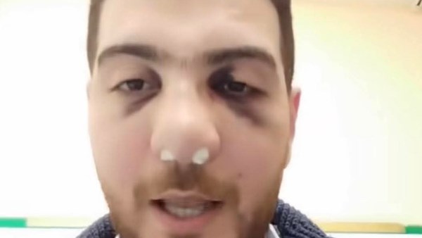 الطبيب المعتدي عليه