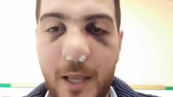 طبيب المنوفية 