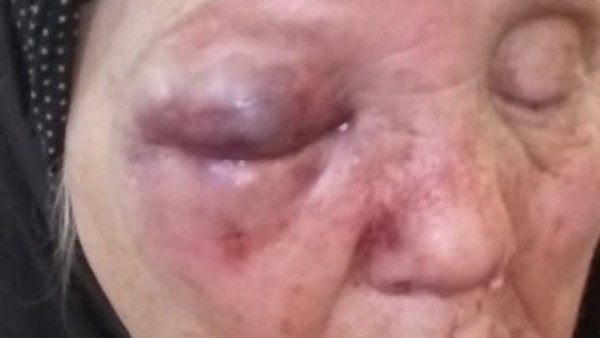 الأم ضحية ابنها بالغربية 