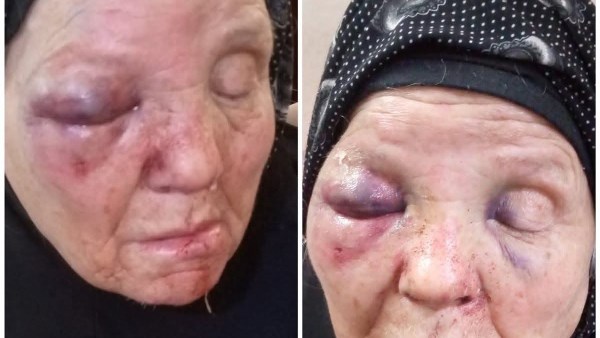 الأم ضحية ابنها بالغربية 