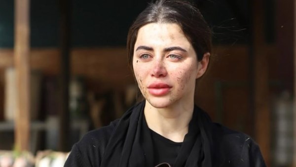 يارا السكري 