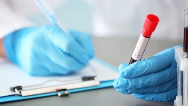 اختبار دم جديد يتنبأ بظهور أعراض الزهايمر قبل سنوات| إيه الحكاية؟