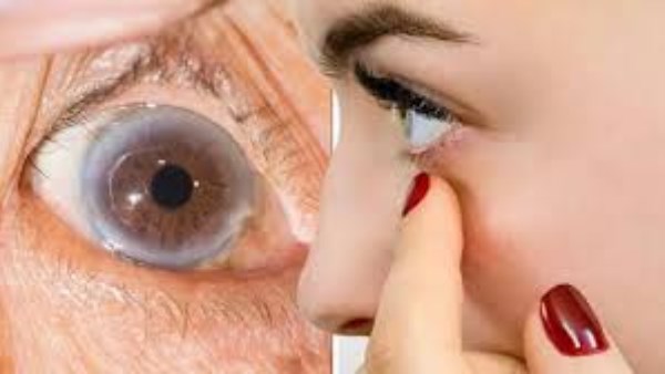 6 علامات قد تكشف ارتفاع الكوليسترول في الجسم  