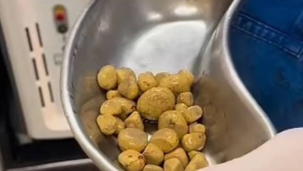 الحليب وحصوات الكلى.. مفاجأة طبية تقلب الموازين: اشربه ولا تمنعه؟ 