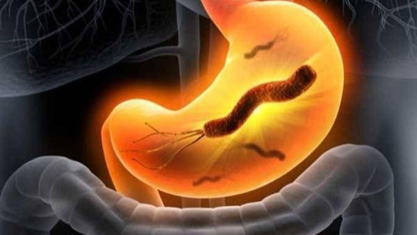 انتبه.. 7 أطعمة قد تُفاقم أعراض جرثومة المعدة وتؤخر الشفاء