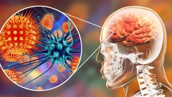 التهاب السحايا .. خطر صامت يهدد الدماغ والحبل الشوكي