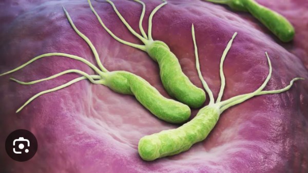 ما هي جرثومة المعدة؟