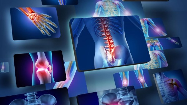 جراحات العظام