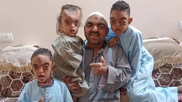 مصري يتعرض للتنمر بسبب أطفاله من ذوي الهمم.. وموجة تعاطف تتصدر السوشيال ميديا