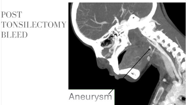 أشعة الطفلة