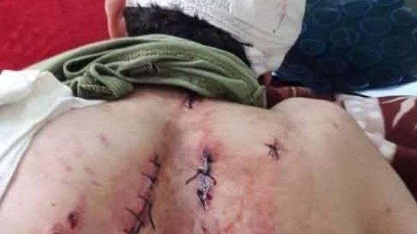 التفاصيل الكاملة للاعتداء على شاب فى بورسعيد دافع عن فتيات من التحرش