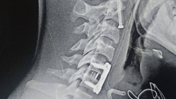 جانب من الجراحة 