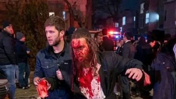 مصاب إسرائيلي 