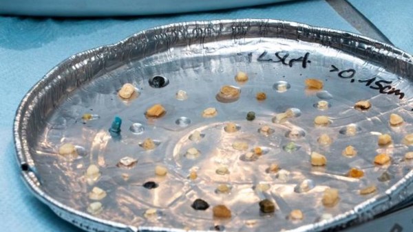 النفايات البلاستيكية