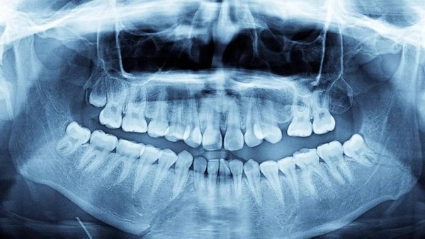 ابتسامة قياسية