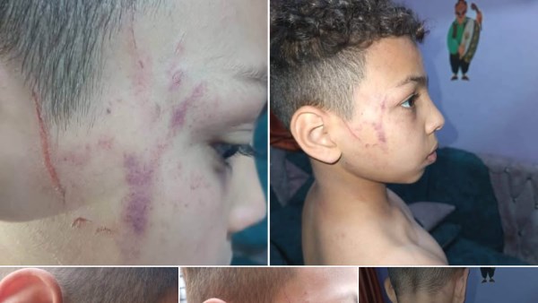 معلمة تعتدي على تلميذ ابتدائي بسوهاج