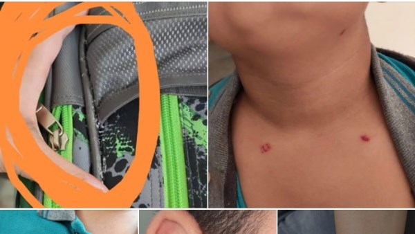 أول رد من مدرسة الطالب المتعرض للضرب والتنمر