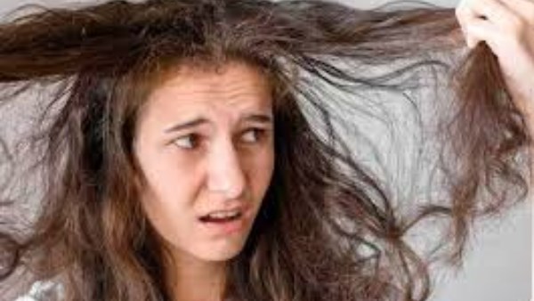 7 أسباب خطيرة وراء تساقط الشعر 