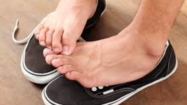 حكة وحرقان بين الأصابع.. تينيا القدم تنتشر بصمت.. طرق علاجها في البيت  