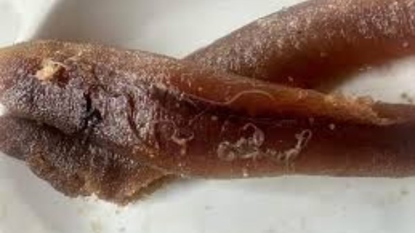 دودة الأنيساكس في أسماك الرنجة المخاطر الصحية وطرق الوقاية