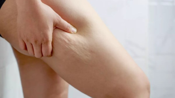  علامات تكشف الاضطراب الصامت لـ الليبوديما 