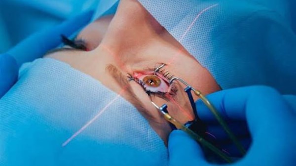 زغللة العين بعد عملية المياه البيضاء