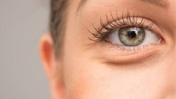 وصفات طبيعية لتفتيح منطقة العين