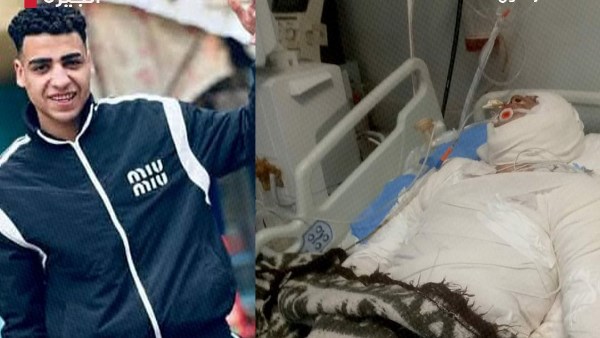 جريمة هزت بولاق الدكرور.. شاب يحرق بالبنزين أمام الأهالي| وجارته: انتقام بعد خلاف