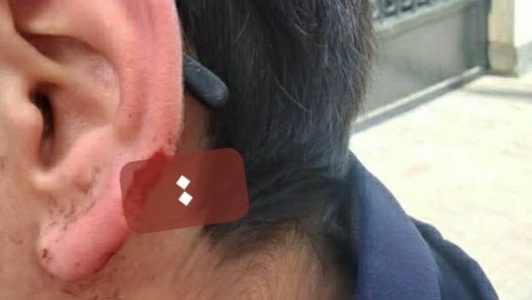 عضة أذن طالب  