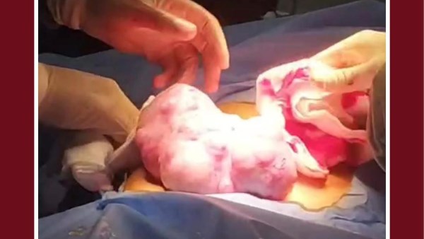 انجاز طبي بمستشفي جامعة طنطا 