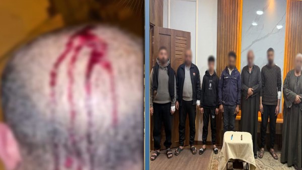 خلافات الجيرة.. القبض على طرفى مشاجرة بالأسلحة البيضاء في البحيرة