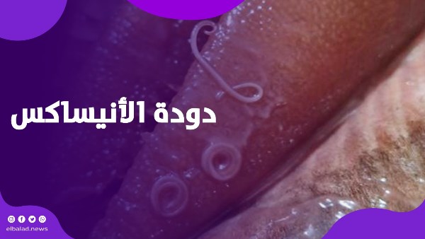 دودة الأنيساكس