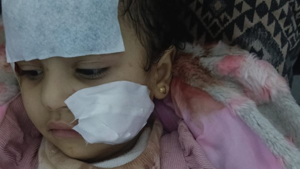 الطفلة المصابة