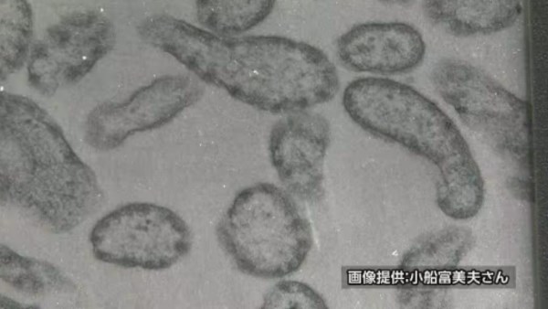 اليابان تسجل زيادة في عدد الإصابات بالحصبة وتحث المواطنين على سرعة تطعيم أطفالهم