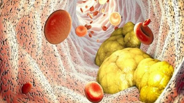  الوزن الطبيعي لا يكفي.. الدهون الخفية خطر صامت داخل الجسم| كيف تتخلص منها؟