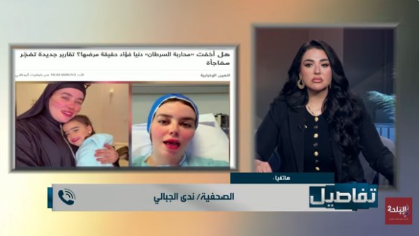 دينا فؤاد