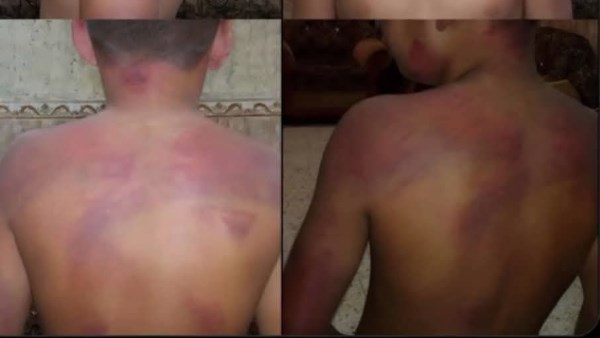 الطفل الذي تم تعذيبه بسوهاج
