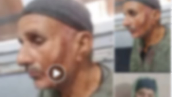 الفيديو