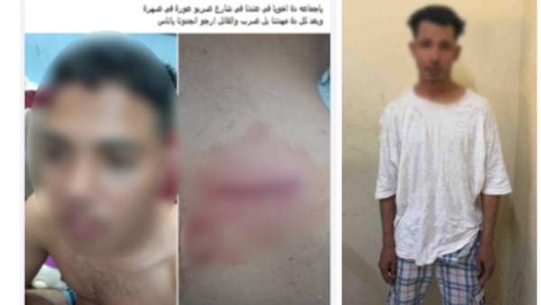 بسبب خلافات الجيرة .. ضبط عاطل تعدى على شاب وأصابه بالجيزة
