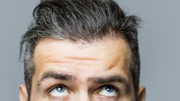 هل نتف الشعرة البيضاء يسبب ظهور المزيد من الشعر الأبيض؟