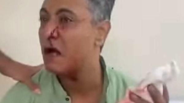 أمن الإسماعيلية يفحص واقعة اعتداء فرد أمن بالمجمع الطبي على مواطن بسلاح أبيض