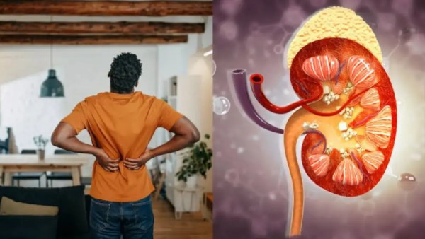 الفرق بين ألم الظهر أم حصوات الكلى